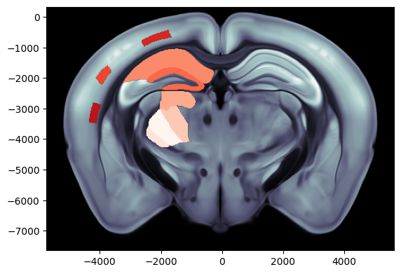 ../_images/notebooks_external_atlas_plotting_scalar_on_slice_12_0.png